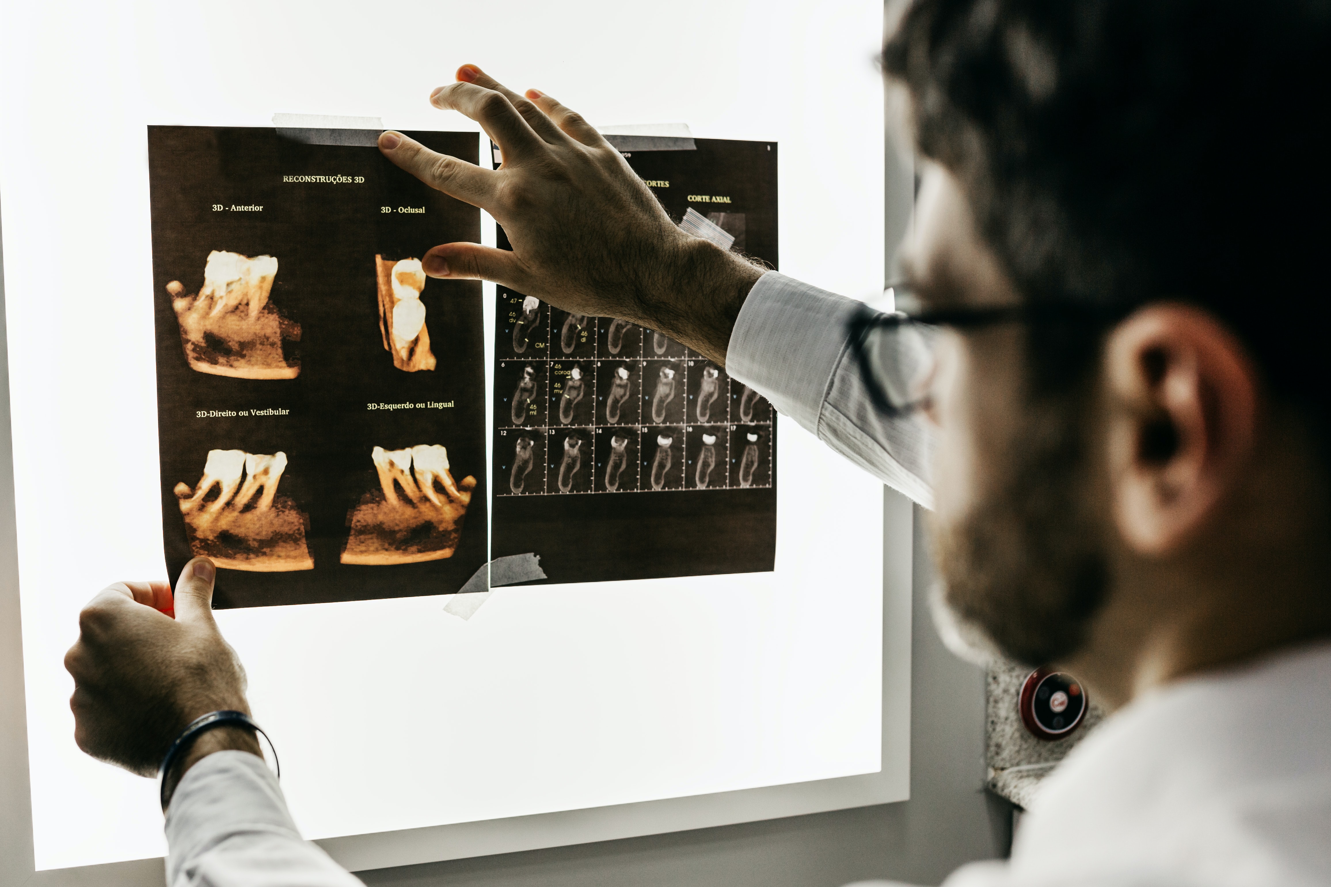 Foto de una persona observando unas radiografías de varias piezas dentales.