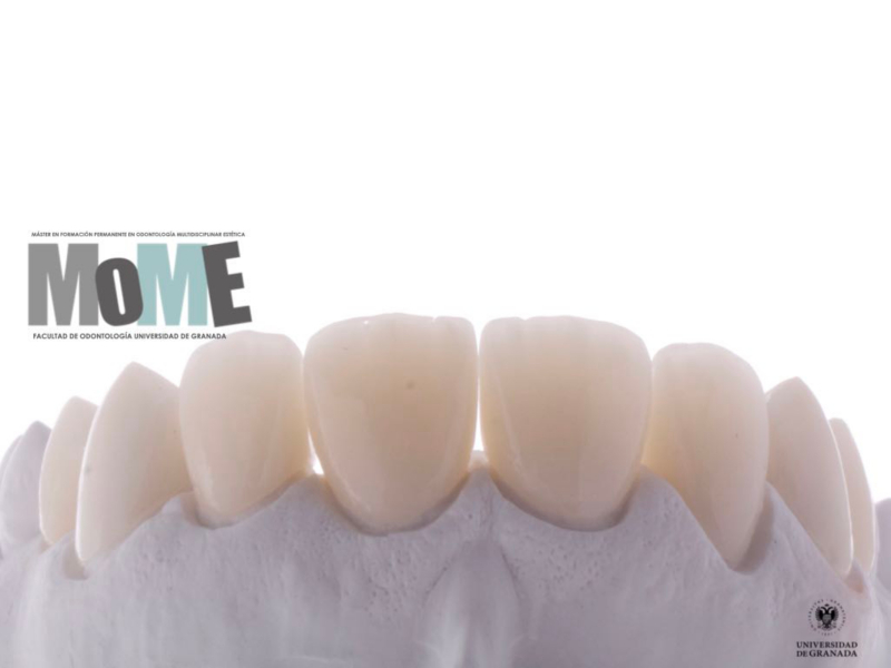 Imagen dentar Imagen dental